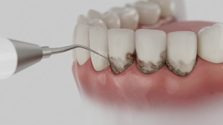Trusted Root Canal Treatment service in Timonium, MD - Dentist Open Now